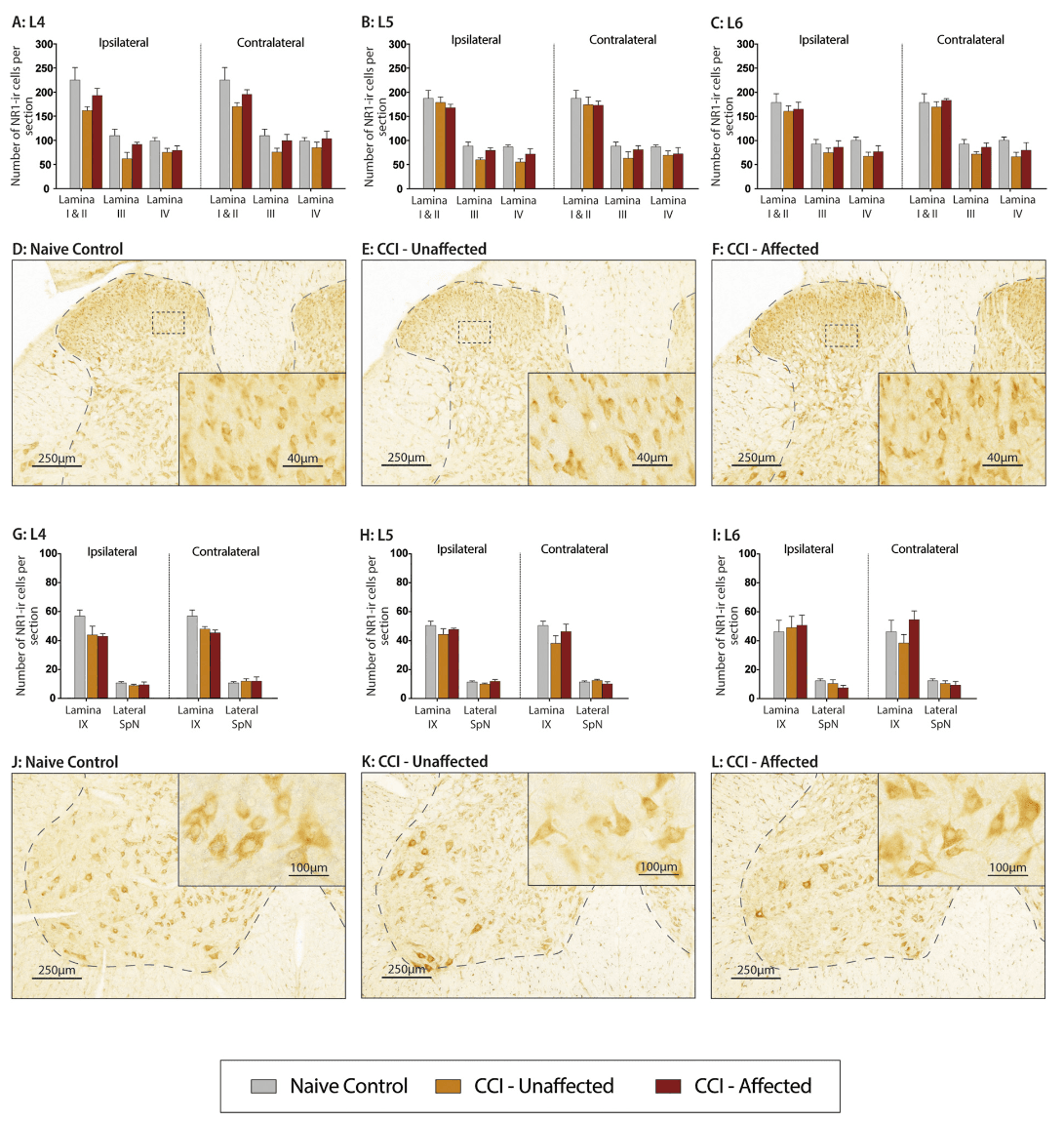 Scientific image accompanying Disability-specific genes GRIN1, GRIN2 and CNR1 show injury-dependent protein expression in the lumbar spinal cord of CCI rats